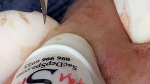 Relax Every Day SacDepSpa #604 (Thanh P2)