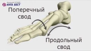 Доктор Карпова Т.В. О плоскостопии и как избавиться