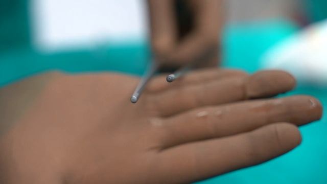 Vaser Liposuction and bbl surgery by dr serkan balta смотреть онлайн