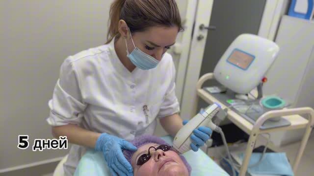 Лазерное омоложение кожи (лазерная шлифовка) процедура, до и после #омоложение #лифтинг #лазер смотреть онлайн