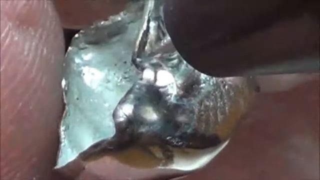Orion Dental Welders porosity fix and margin extension 121313 смотреть онлайн