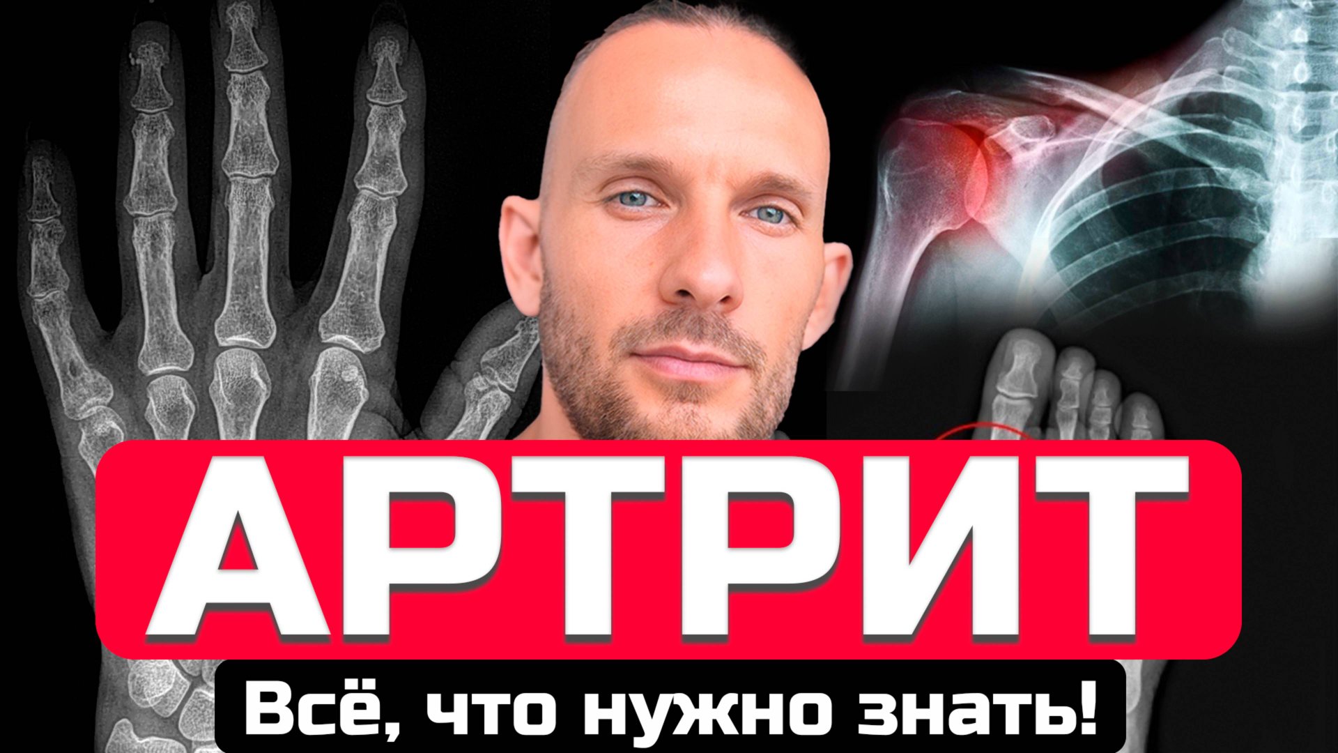 Я просто хотел ответить на голосовое сообщение, что такое ревматоидный артрит смотреть онлайн