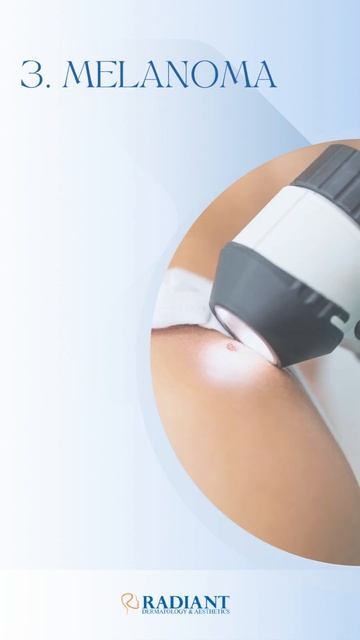 Types Of Skin Cancer смотреть онлайн