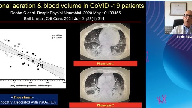 Should we intubate the happy hypoxic COVID-19 patient Con Paolo Pelosi 2021