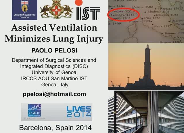Protective ventilation during spontaneous breathing Paolo Pelosi 2014