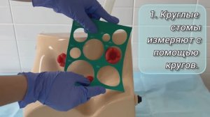 Измерение стомы