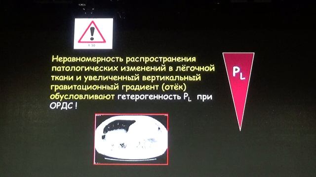 Золотой юбилей ОРДС стала ли ИВЛ более безопасной  Николаенко Э.М.