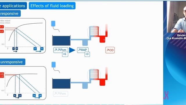 From Guyton to modern intensive care applied physiology Xavier Monnet 2021