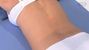 HILT - Терапия