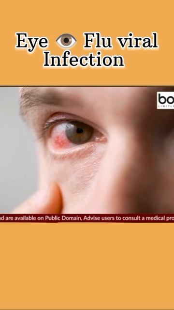 Eye 👁️ Flu 😷 viral infection #eyeflu #infection #viral#shorts #youtubeshorts#shortvideo#viralshorts смотреть онлайн