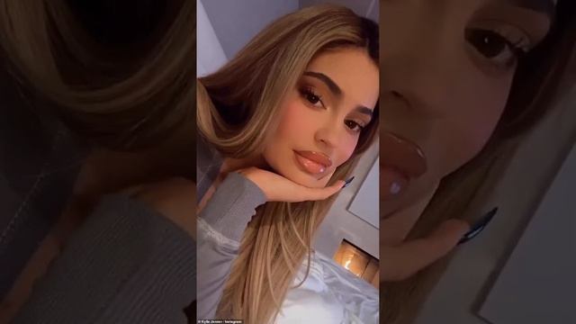 Lips Bigger Than Kylie Jenner’s💋(RUSSIAN Lip Filler Effect 💉)