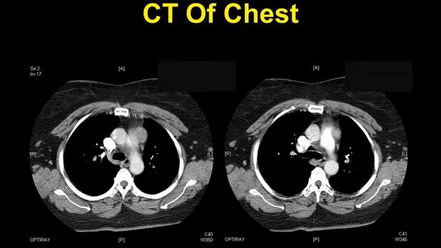 Case Presentation 549 X R TALKS Part 30 смотреть онлайн