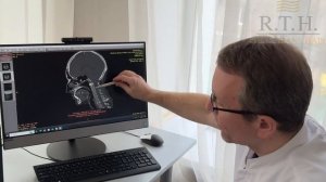 Хирургическое лечение храпа