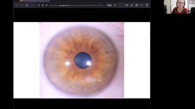Comparing Jensen-style iridology to Constitutional iridology смотреть онлайн