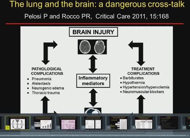 General management of NICU patients Mechanical ventilation Paolo Pelosi 2014
