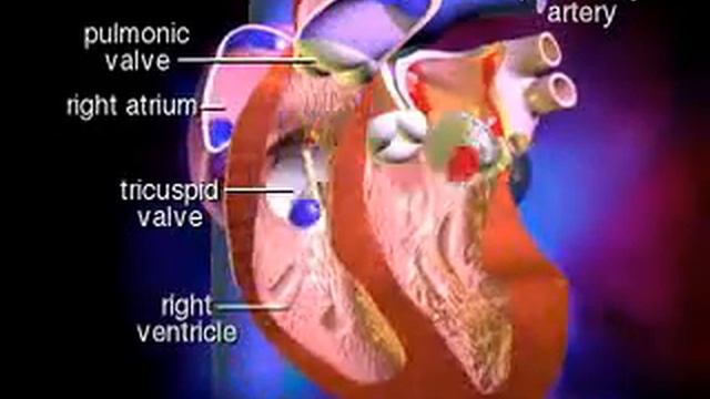 Mitral Valve Stenosis смотреть онлайн