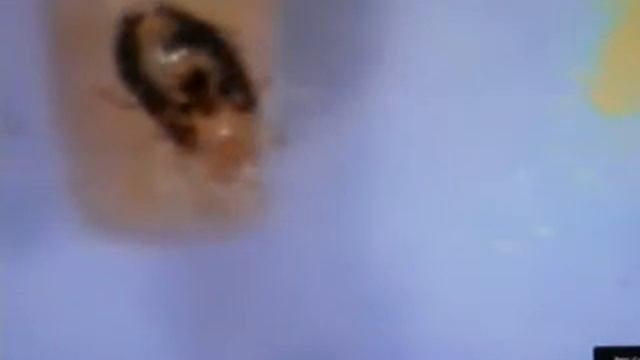 ミクロのダニ смотреть онлайн