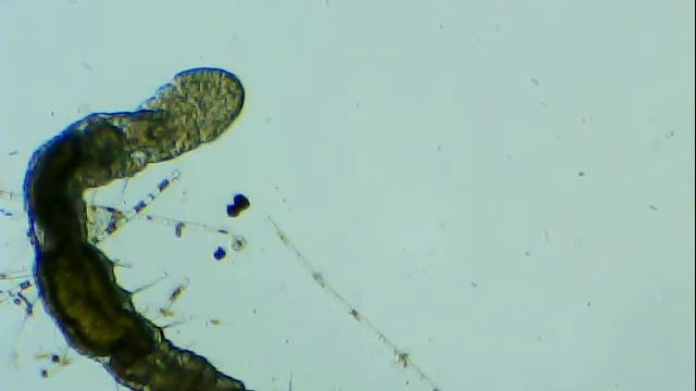 Ondas peristálticas en Aeolosoma смотреть онлайн