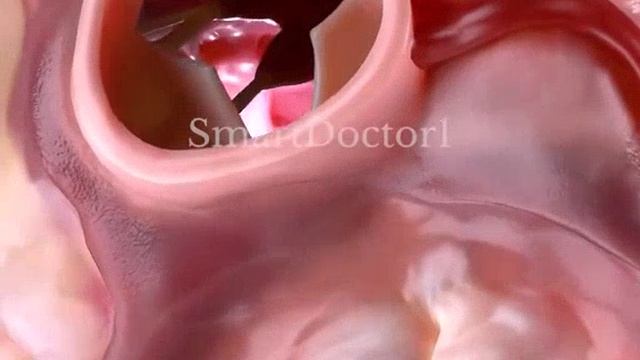 🚑5 полезных сладостей для сердца🚑👉В ОПИСАНИЕ👈