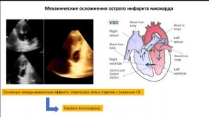 ВБАК в кардиологии Арболишвили ГН 2021