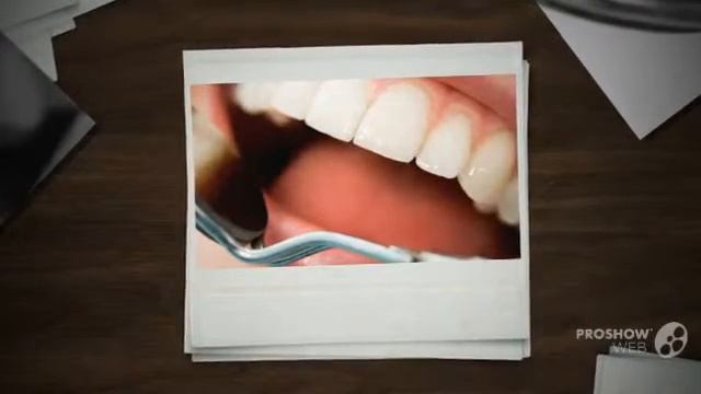 домашние отбеливание зубов - Как отбелить зубы без вреда смотреть онлайн