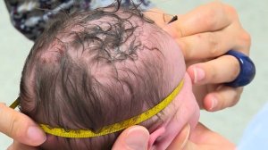 Intergrowth 21st Project - Head circumference training video