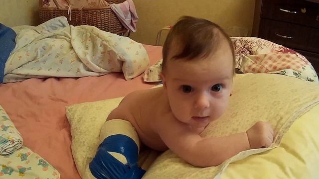 врожденный вывих бедра у ребенка(Congenital hip dislocation) смотреть онлайн