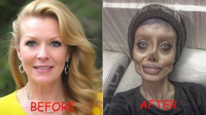 10 историй людей, Чьи Пластические Операции Шокировали Мир