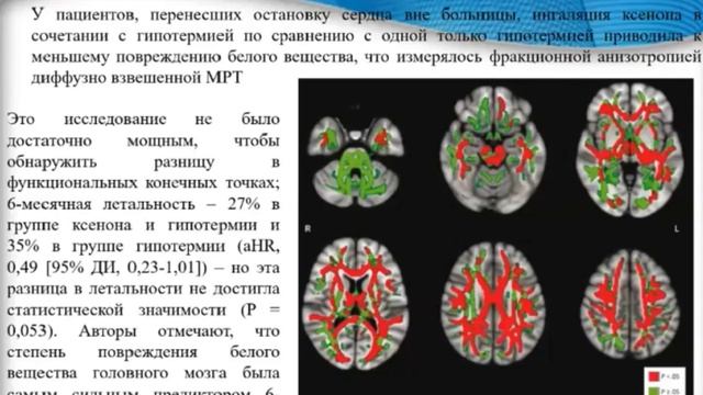Нейропротекция Ксенон Гребенчиков О.А. 2021