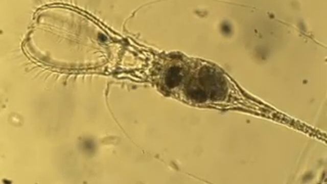 Stephanoceros spp. смотреть онлайн