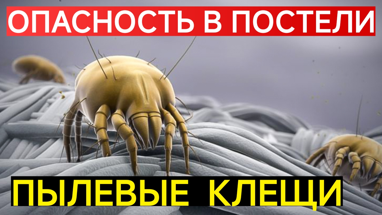 ПЫЛЕВЫЕ КЛЕЩИ.ОПАСНОСТЬ В ВАШЕЙ КРОВАТИ. ОТКУДА БЕРУТСЯ? И КАК БОРОТЬСЯ? НАРОДНЫЕ СПОСОБЫ.