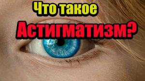 Что такое астигматизм? 👁🗨 Как его лечить?