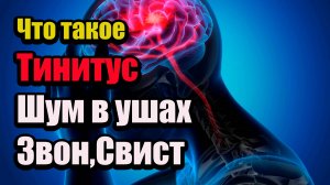 Что такое Тинитус (Шум в ушах)звон,свист