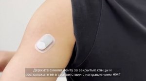 Дополнительные методы наложения ленты для НМГ S9