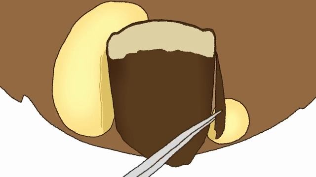Bear's Ingrown Toenail Removal Treatment [ASMR Animation]
