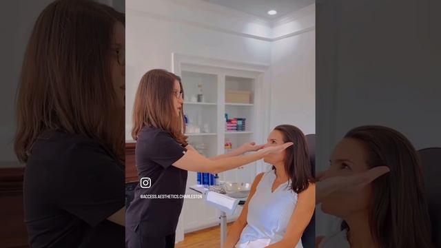 Filler for facial volume loss смотреть онлайн