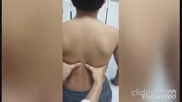 SEMIOLOGIA DE TORAX смотреть онлайн