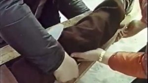 Первая медицинская помощь при переломах. Учебный фильм