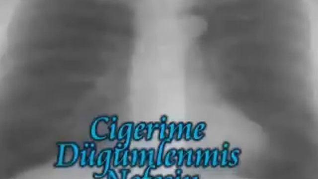 Umut Altincag-Seni Her Nefeste Özledim Bugün смотреть онлайн