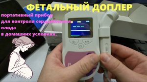 Фетальный допплер MED-MOS Sonoline C слушаем сердце малыша дома