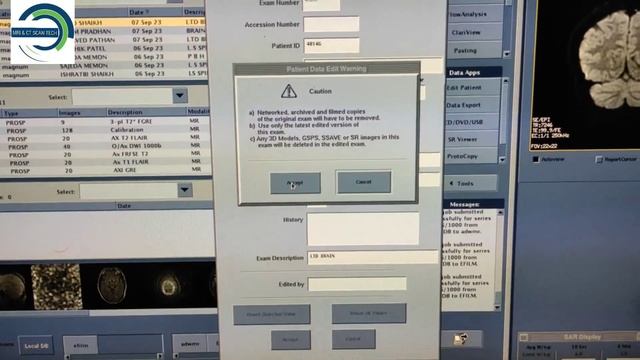 How to Edit MRI Data on GE 1.5 Tesla on YouTube смотреть онлайн