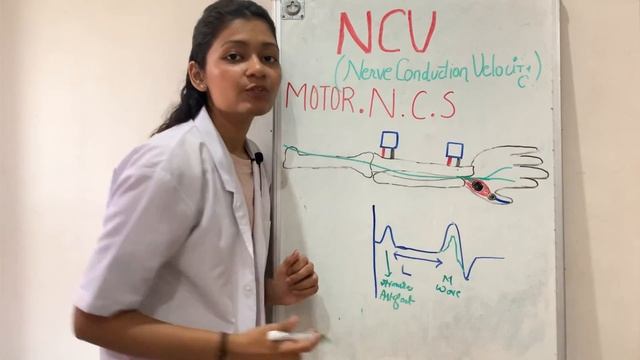 NCV test | Motor and sensory nerve conduction studies explained смотреть онлайн