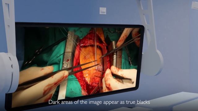 AUO Display Plus - Display Solutions for Smart Surgery смотреть онлайн
