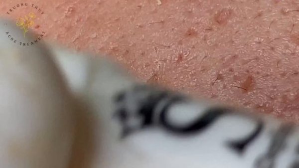 Satisfying Relaxing with Sac Dep Spa Video (#161)