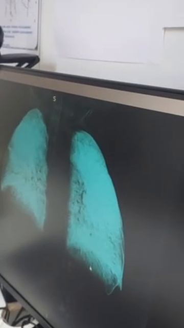 Последствия для наших храбрых воинов, после операции, благодаря которой, смотреть онлайн