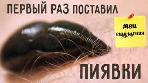 Самостоятельно поставить пиявки. Гирудотерапия в домашних условиях. Впервые ставлю пиявки САМ!