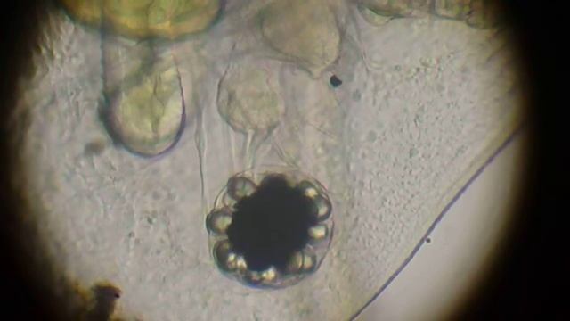 Detail of Daphnia mendotae eyes смотреть онлайн