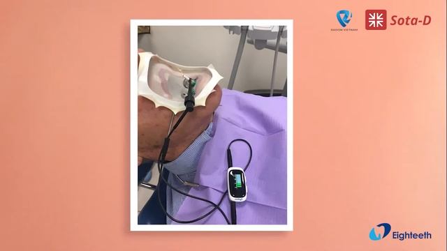 NÂNG TẦM CHẤT LƯỢNG PHÒNG KHÁM VỚI MÁY ĐỊNH VỊ CHÓP AIRPEX - EIGHTEETH смотреть онлайн