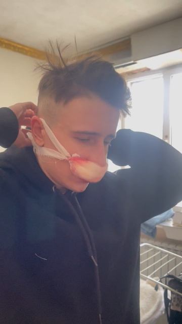 Травма после похищения