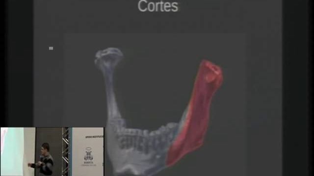 Planejamento de cirurgia Dento-facial com o Blender 3D смотреть онлайн